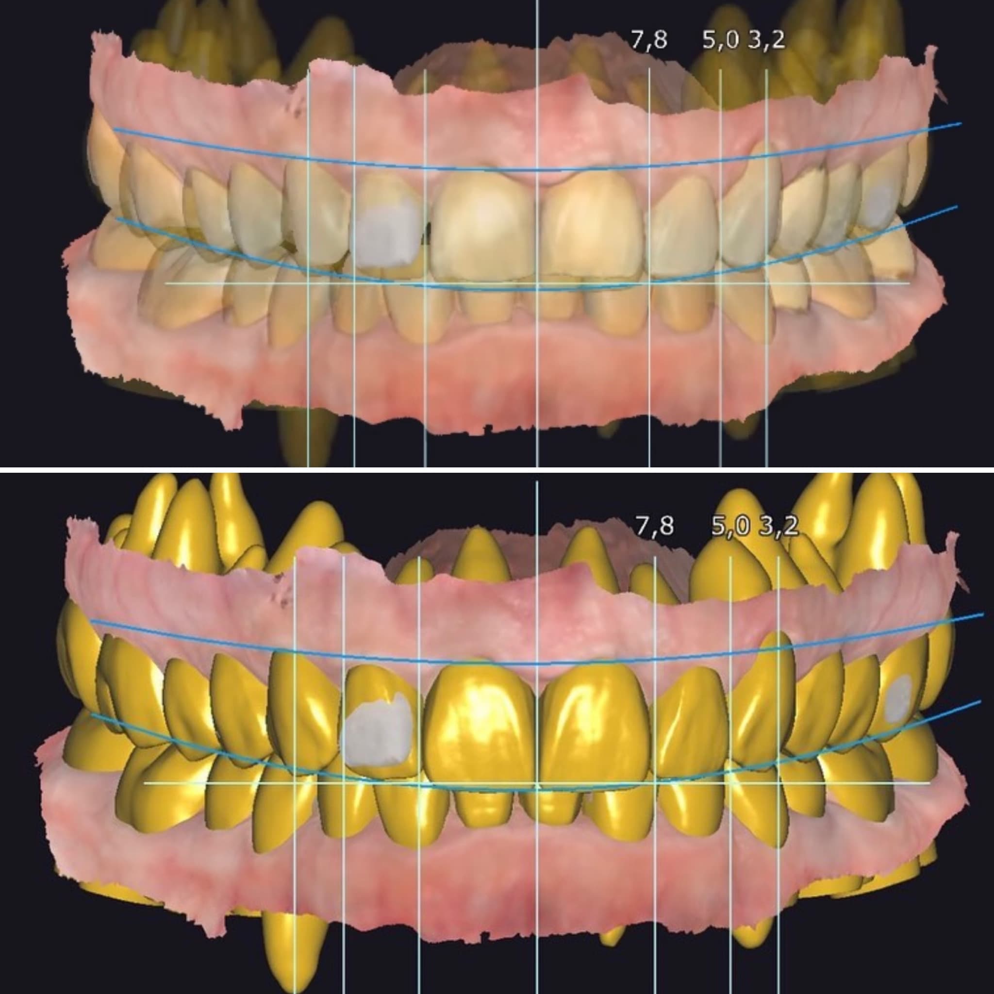 Digital Dentistry at Strupp & Brumm, Clearwater FL